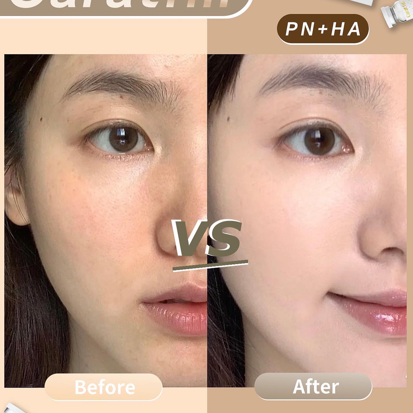 Caratfill Filler Skin Booster Hyaluronic Acid 5.2ml 10 Visa Injection Essence Firming, Moisturizing and Anti-Aging