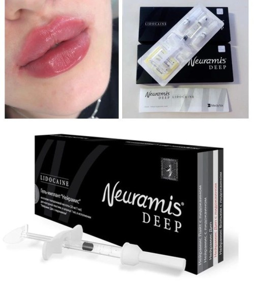 Neuramis Hyaluronic Acid Dermal Filler for Cheeks Chin Forehead Lips Nose