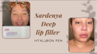 Wholesale Korean Sardenya Dermal Filler Hyaluronic Acid Injection