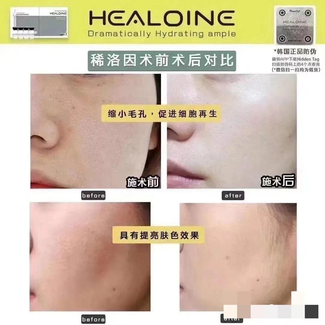 2024 The Latest Hot-Selling Product in Gangnam, South Korea, Healoine Skin Ampule, The Highest Concentration Skin Boost