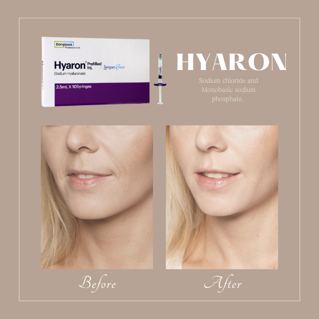 Korea Hot Selling Hyaron Ha Filler Anti-Aging Skin Moisturizing