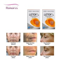 Anti Wrinkle Botulinum Toxins Coretox 100u Lyophilized Medytox Powder Injection