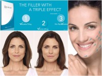 radiesse filler with Lidocaine (1x1.5ml)