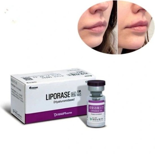 Hyaluronidase 1500iu Liporase powder to Remove hyaluronic acid