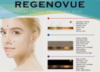 Regenovue Fine Deep Sub-Q Cross Linked Hyaluronic Acid Ha Dermal Filler