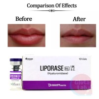 Korea Hyaluronidase Liporase Hyaluronic Acid Dermal Filler Dissolving