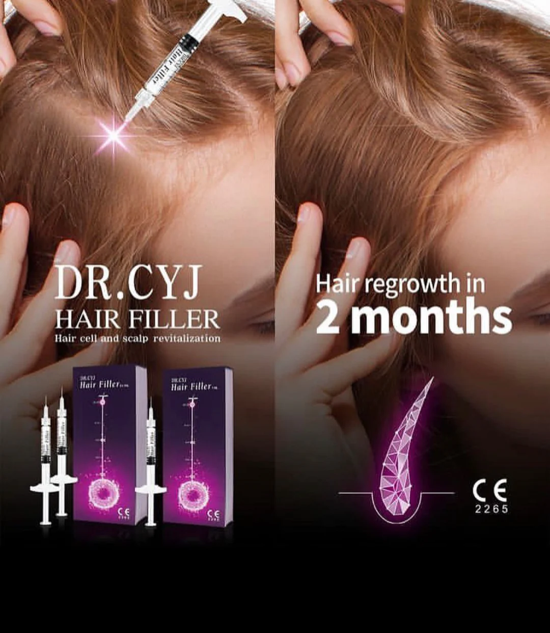 Dr. Cyj Hair Filler 1ml. Is The World′s First Filler Bioreparant for Intensive Hair Follicle Regeneration and Hair Grow