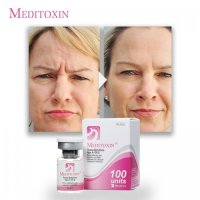 Factory Supply Neotox Wrinkle Remove 50iu 100iu Best Price Medi Toxin Anti Wrinkle Remove 200iu for Face Boto Toxi Hyla