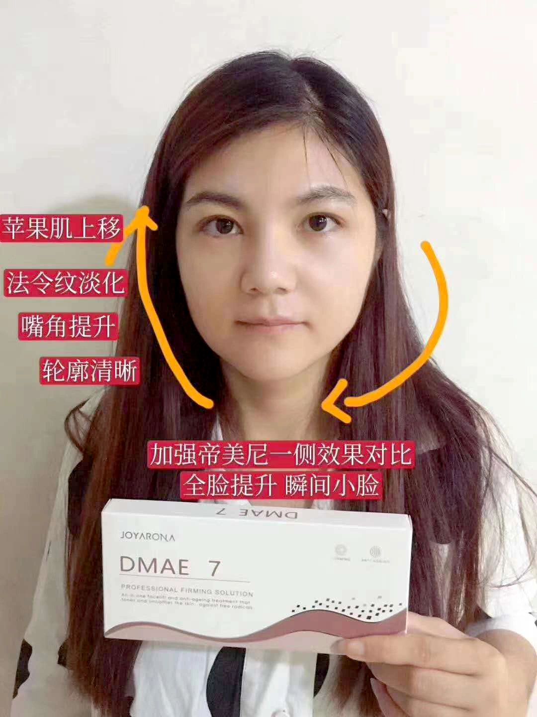 Joyarona Dmae Profhilo H+L Face Lifting Winkle Removal Ibsa Profhilo Nucleofill Strong Bellona Pcl Joyarona Dmae 7 The