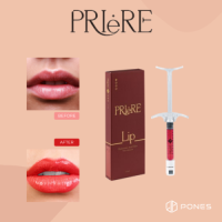 Korea Popular Treatment Priere Lips Filler Hyaluronic Acid Dermal Filler Ha Filler Contains Vitamins for Lips Enhanceme