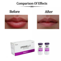 Liporase Dissolve Hyaluronic Acid Hyaluronidase Liporase Injection Lipolab to Remove Fillers