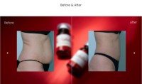 Hot Selling Slimming Injection Kabelline Ppc Body Sculpting Serum for Weight Loss