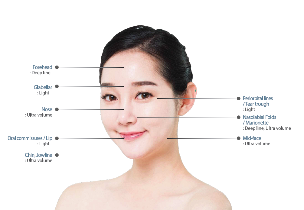 Metoo 1.1ml Fill Volume with Cecross-Linked Injectable Facial Hyaluronic Acid Dermal Filler Lip Filler Nose Chin Medam