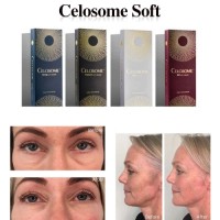 Celosome 1.1ml Injectable Hyaluronic Acid Dermal Fillers 24mg/Ml Lip Fillers