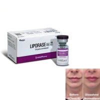 Liporase Hyaluronidase Injections Dissolves Hyaluronic Acid