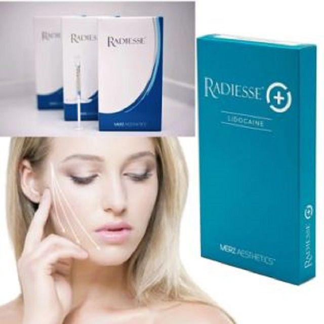 radiesse filler with Lidocaine (1x1.5ml)