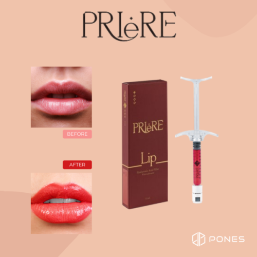 Priere Lip Fillers Nourish Hyaluronic Acid Dermal Filler Ha Filler Contains Vitamins for Lips Enhancement