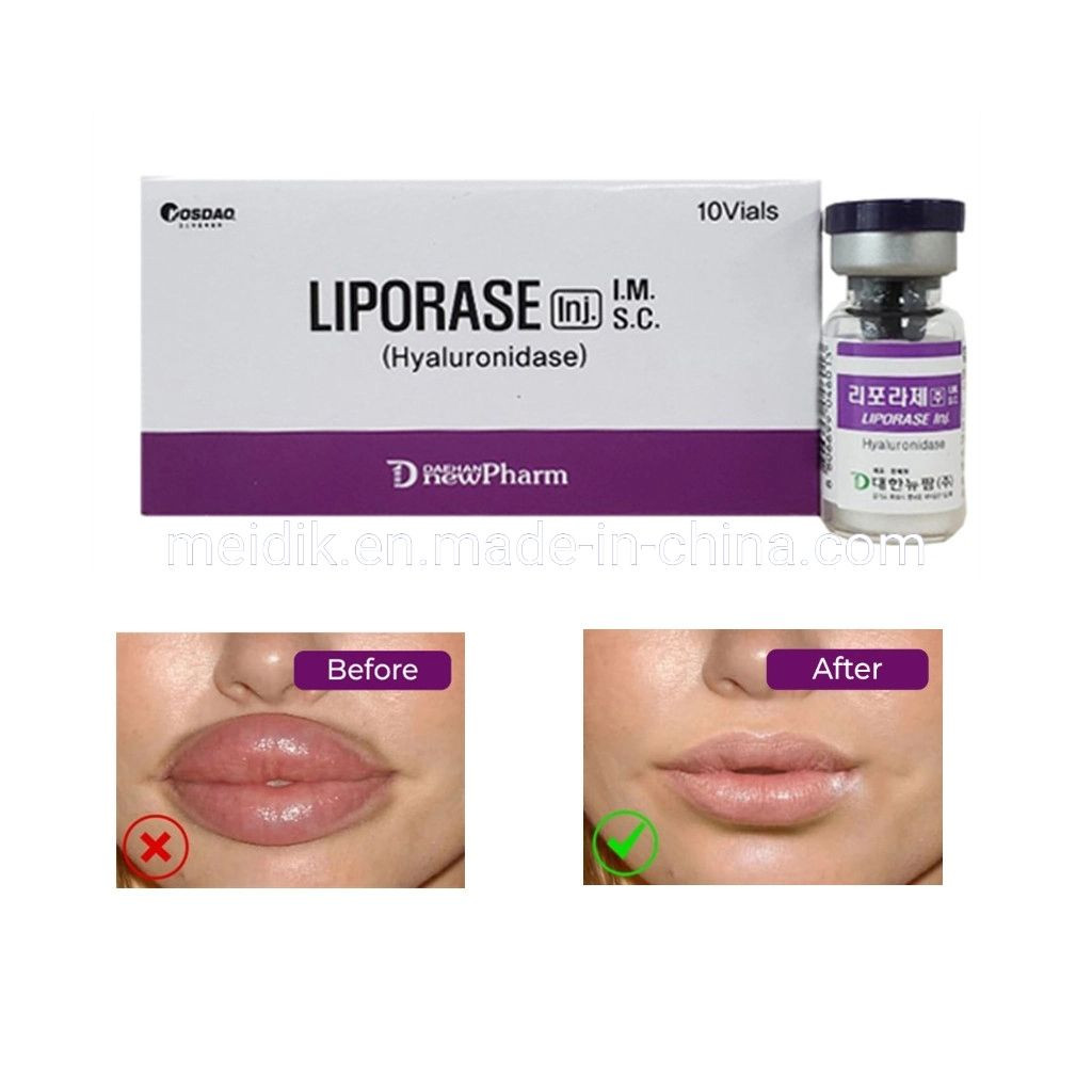 Korea Hyaluronidase Liporase Hyaluronic Acid Dermal Filler Dissolving