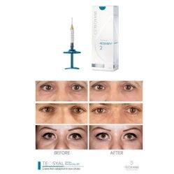 2024 Top Teosyal Redensity 2 Puresense (2X1ml) Teoxane Under Eye Circle Fighter Filler Black Eye Removal European Origi