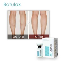 Botulax 100 200 300 Injection Anti Aging Directly Supply Best Seller For Face Body Frown