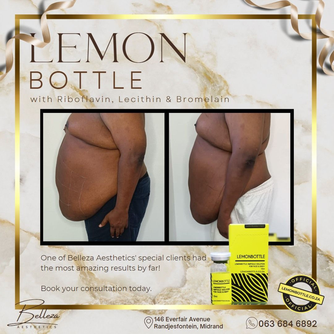 hot selling Lemon Bottle 10ml*5 Dissolves Excess Fat and Loses Weight Lipolab Kabelline