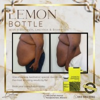 hot selling Lemon Bottle 10ml*5 Dissolves Excess Fat and Loses Weight Lipolab Kabelline